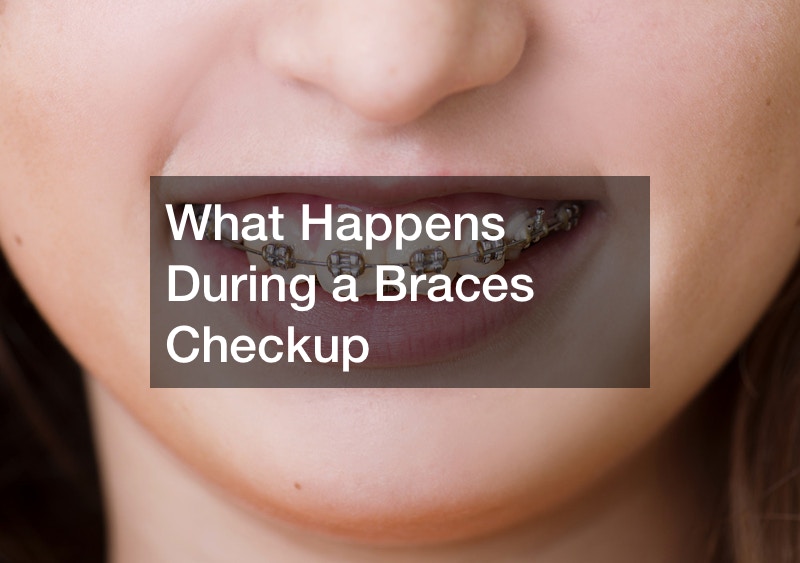 What Happens During a Braces Checkup